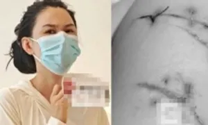 Thoát chết nhờ túi độn ngực Thoát chết nhờ túi độn ngực